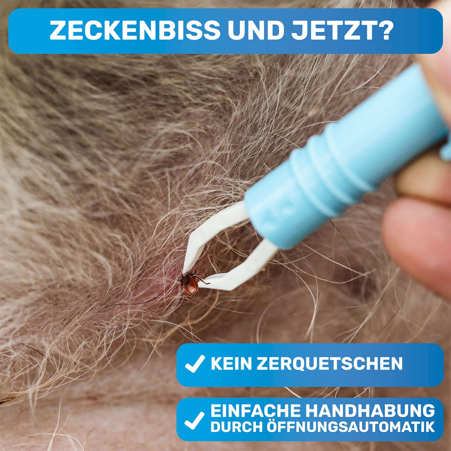 2x Automatische Zeckenzange, Zeckenentferner