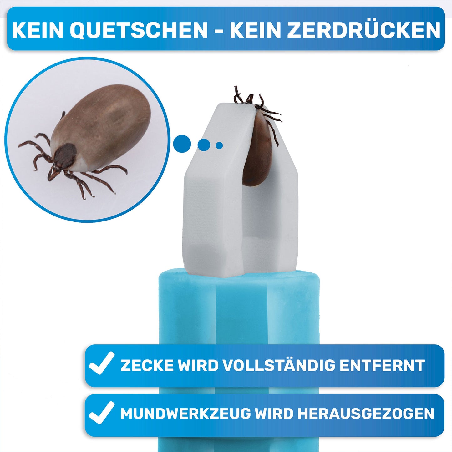 2x Automatische Zeckenzange, Zeckenentferner